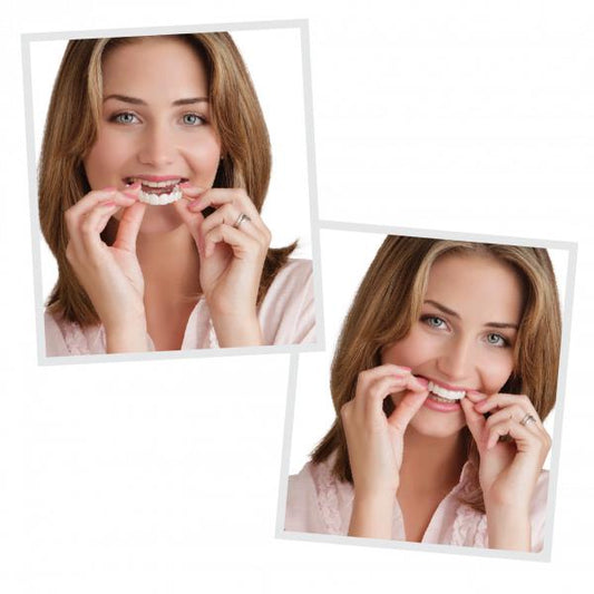 Artificial Teeth Braces for Perfect Alignment, Artificial Braces for a Straighter Smile